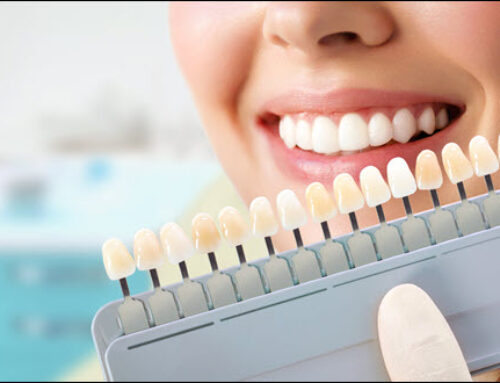 Restoration: Repairing Damaged Teeth for Radiant Smiles