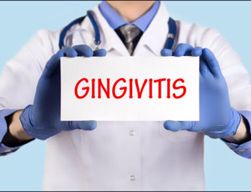 Gingivitis Guard: Simple Habits for Gum Health