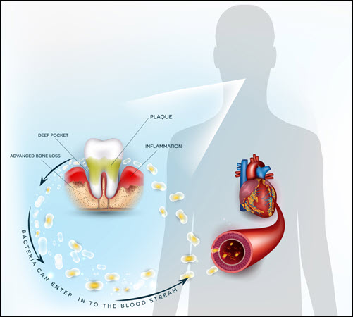 Heart Health