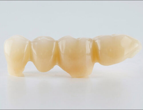 How Dental Bridges Restore Your Smile