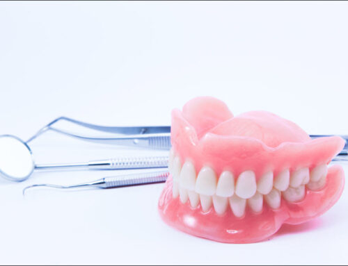 Comparing Dentures and Implants: Which Is Right for You?