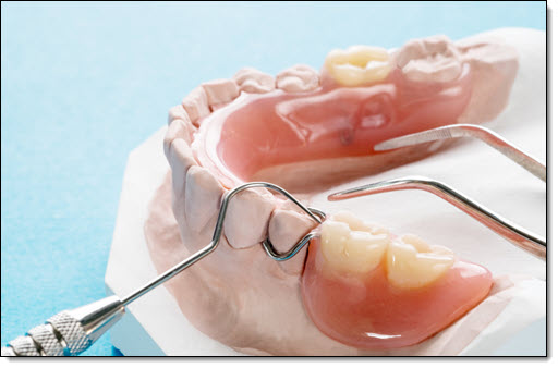 Dentures