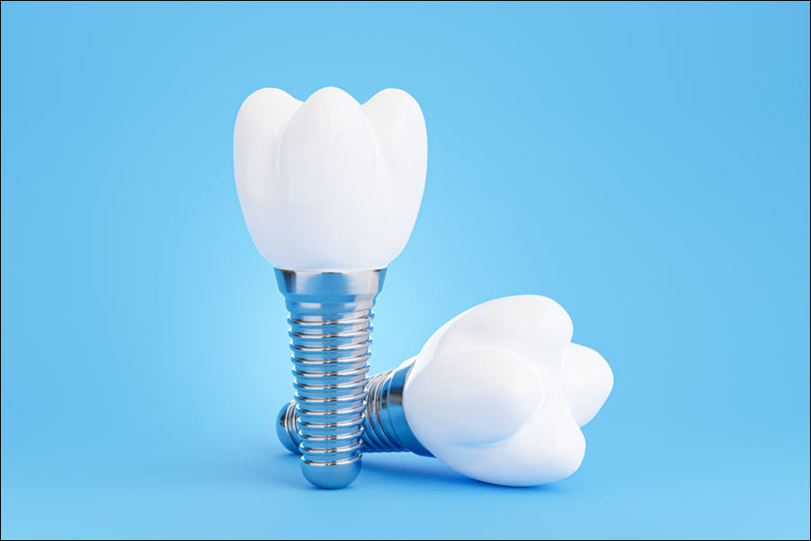 Implants