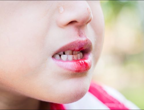 Dental Emergencies and First Aid Dentistry: What to Do Fast