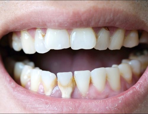 Gum Pain: Common Causes and When to See a Dentist